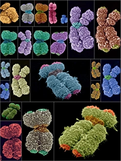 Human Chromosomes SEM Drucke: Human chromosomes, SEMs