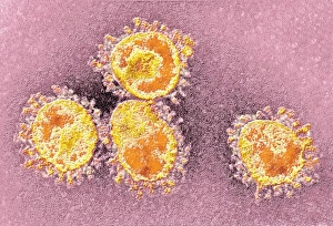 Coloured Transmission Electron Micrograph Drucke: Human coronavirus, TEM
