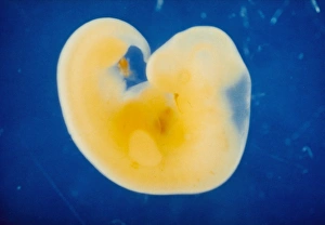 Human Embryo Development Drucke: The human embryo at four weeks of gestation