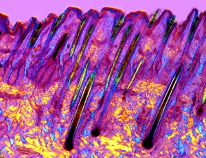 Human Skin Anatomy Drucke: Human skin, polarised light micrograph