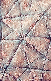 Human Skin SEM Drucke: Human skin surface, SEM