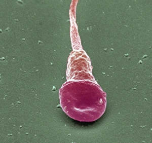 Coloured Scanning Electron Micrograph SEM Drucke: Human sperm cell, SEM