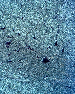 Light Microscopy Images Drucke: Human spinal cord, light micrograph