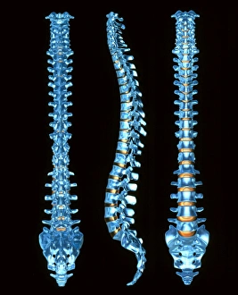 Human Spine Anatomy Drucke: Human spine, three views
