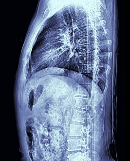 Menschliches Torso, MRT-Scan
