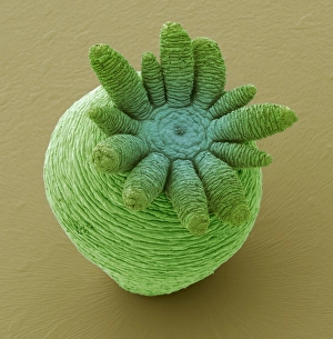 Bilder vom 7. März 2013: Hydra, SEM = Hydra (Lebensform), Scanning Elektronenmikroskop