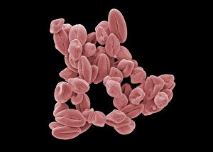 SEM Images Of Pollen Drucke: Hypericum pollen