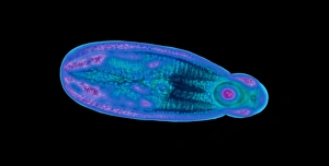 Light Micrograph Images Drucke: Immature fluke, light micrograph