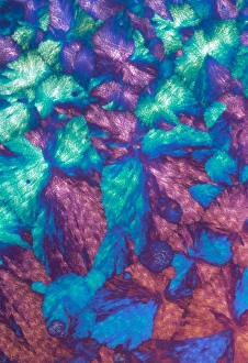 Polarised Light Microscopy Drucke: Immunoglobulin crystals, light micrograph