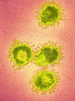 Infektionsbronkitisvirus (IBV), TEM