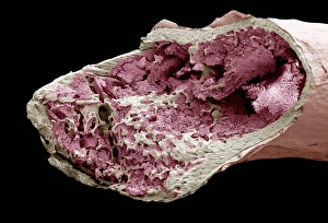 Drucke von Das Innere eines Knochens. Farbige Rastertonenmikroskopie (SEM) einer langen Knochen mit aufgebrochener Oberfläche um das innere Verhältnis zu zeigen Bilder Datiert 2007 April: Innere Struktur eines Knochens (SEM)