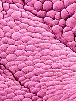 Innere Wand des Uterus, SEM