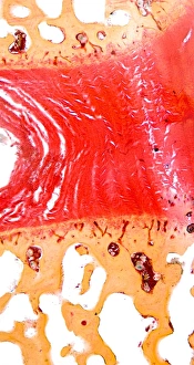 Light Micrograph Drucke: Intervertebral disc, light micrograph