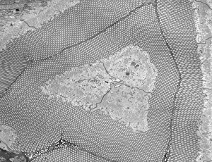 Bilder Datiert 14. Februar 2013: Darmgrenzrand, TEM