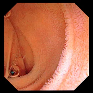 Bilder Datiert 2012 April: Intestinal lining