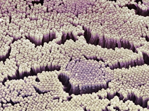 Drucke von Intestinale Mikrovillen. Farbige Rasterelektronenmikroskopaufnahme (SEM) von Mikrovillen aus dem Duodenum, der ersten Teile des Darmes Bilder Datiert 2003 August: Darmmikrovillen, SEM