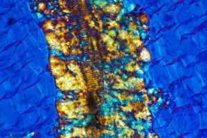 Polarised Light Microscopy Drucke: Inulin crystals, light micrograph