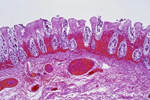 Bilder Datiert 27. März 2013: Iskämisches Darm, leuchtendes Mikroskopbild