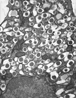 Drucke von Inseld von Langerhans beta-Zelle. Transmissionselektronenmikroskopbild (TEM) einer Schnittstelle durch eine Beta-Zelle in einem Inseld von Langerhans im Pankreas Bilder Datiert 2013 Februar: Insel der Langerhans-Zellbeta-Drüsen unter dem Elektronenmikroskop (TEM)