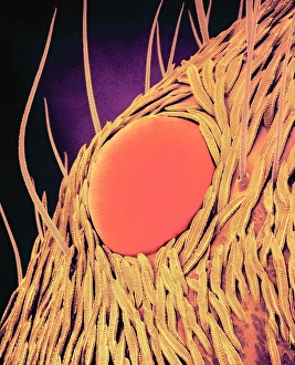 Drucke von Das Augenpaar des Sprungspinners. Farbiger Scanning-Elektronenmikroskop (SEM) der einfachen Augen (Ocelli, orange) eines Sprungspinnens (Familie Salticidae) Bilder Datiert 2002 August: Springbrustspinnenschild, SEM