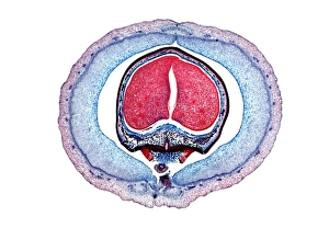 Light Microscopy Images Drucke: Kidney bean, light micrograph