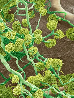 Scanning Electron Microscope Images Drucke: Kidney glomeruli, SEM