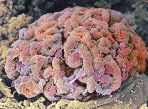 Bilder aus dem Jahr 2000: Nierenkloßchen