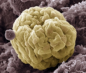 Drucke von Nierenglomerulus mit Farbuntersuchung unter dem Elektronenmikroskop (SEM), der Pflanzengitterzellen auf der Oberfläche des Gomulum sind gelb Bilder Datiert 2008 Mai: Nierenglomerulus, SEM