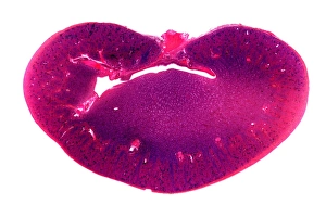 Kidney Anatomy Drucke: Kidney, longitudinal section