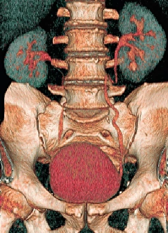 Kidney Anatomy Drucke: Kidneys and bladder, 3D CT scan