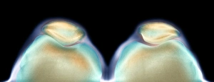 Drucke von Knöchelknochen. Farbige Röntgenaufnahme der Knöchelknochen eines gesunden Erwachsenenmannes aus oben gesehen bei gebogenen Kniegelenken Bilder Datiert 2004 Februar: Knöchelknochen, Röntgenbild