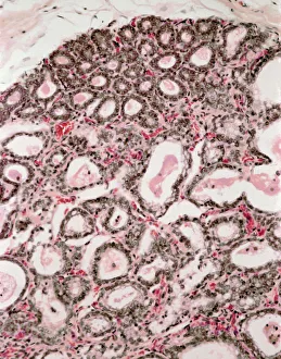 Menschlicher Körper Drucke: Milchdrüsenweiches Brustgewebe, Lichtmikroskopie