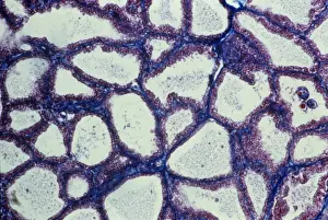 Milchdrüsenweiches Gewebe, Lichtmikroskopie C015/7102