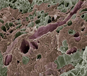 Milchdrüsenweiches Gewebe im Mikroskop (SEM)