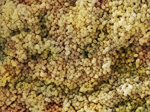 Scanning Electron Micrograph SEM Drucke: Lactococcus sp. Bacteria (SEM)