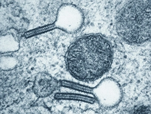 Drucke von Langhaarszelle mit farbiger Transmission-Elektronenmikroskopie einer Schnittstufe durch eine Langhaarszelle aus der Epidermis der Haut. Die Tennisracket-geformten Objekte sind Birbeckgranulae Bilder Datiert 2011 August: Langhandzellen-Zell, TEM