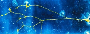 Human Nervous System Anatomy Drucke: Light micrograph of a nerve cell