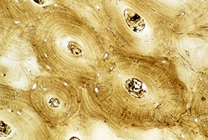 Drucke von Ein Lichtmikroskopbild einer Kreuzsection eines normalen menschlichen kompakte Knochengewebes, wie es in den Schienbeinen der langen Knochen vorkommt, zum Beispiel im Falle des Femurs Bilder Datiert 2003 Oktober: Bild des Lichtmikroskops von normalem menschlichem kompaktem Knochen