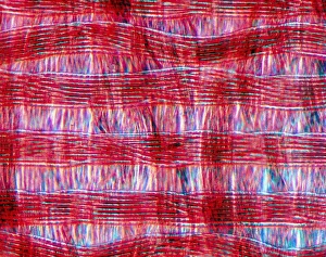 Light Microscopy Images Drucke: Light micrograph of polyamide in tissue