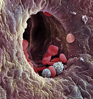 Drucke von Nierenkapillar. Farbener Scanningelektronenmikroskopgraphie (SEM) einer gefriertem Fragment durch Lebergewebe, die Hepatiskapillardruse oder Sinusoid zeigt Bilder Datiert 2003 Januar: Leberkapillar, SEM
