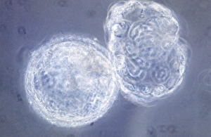 Bilder aus dem Jahr 1990: LM des im IVF eingesetzten Blastozysten bei der Eizellentwicklung