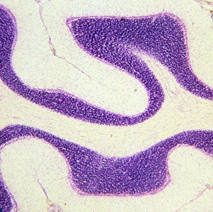 Central Nervous System CNS Drucke: LM of section through cerebral cortex and medulla