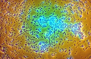 Gram Positive Bacteria Drucke: LM of staphylococcus aureus