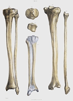 Drucke von Unterbein-Knochen und Sehnen. Historische anatomische Kunstwerke von Unterbein-Knochen (gelb) und Sehnen (paleblau) Bilder Datiert 2005 Januar: Untere Schienbein- und Sehnenknochen