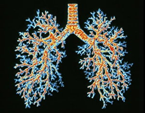 Drucke von Lungenluftwege. Computerverstärkte Abbildung eines Gipsmodells der Luftwege im Lungekreislauf. Die Trachea (Luftpfeife, mittig oben) teilt sich in zwei Hauptbronchi ein Bilder Datiert 2003 Februar: Lung airways