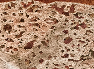 Human Body Biology Drucke: Lung alveoli, SEM