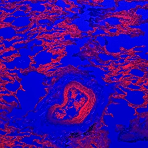 Confocal Microscopy Images Drucke: Lung tissue, confocal micrograph C014 / 4616