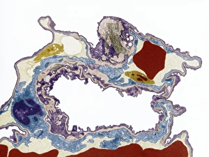 Drucke von Lungeneweiss, farbgebundene Transmissionelektronenmikroskopaufnahme (TEM). Ein einzelner Alveolus befindet sich im Mittelpunkt Bilder Datiert 2008 Mai: Lungegewebe, TEM