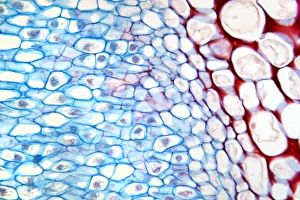 Drucke von Die Lupinwurzelknögel sind eine Mikrographie einer Schnittstelle durch einen Wurzelnodul der Pflanze Lupinus lupus. Die Wurzelnoderen des Lupinspflanzens sind voller nitrogenfixierender Rhizobiumsp Bilder Datiert 2012 Januar: Lupinus-Stecklinge Nodulatoren, Lichtmikroskopie