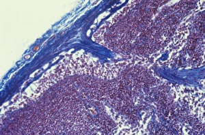 Human Immune System Cells Drucke: Lymph node, light micrograph C015 / 6222